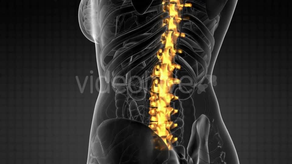 Backache in Back Bones - Download Videohive 21225268