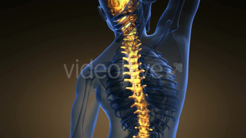 Backache in Back Bones - Download Videohive 21225321