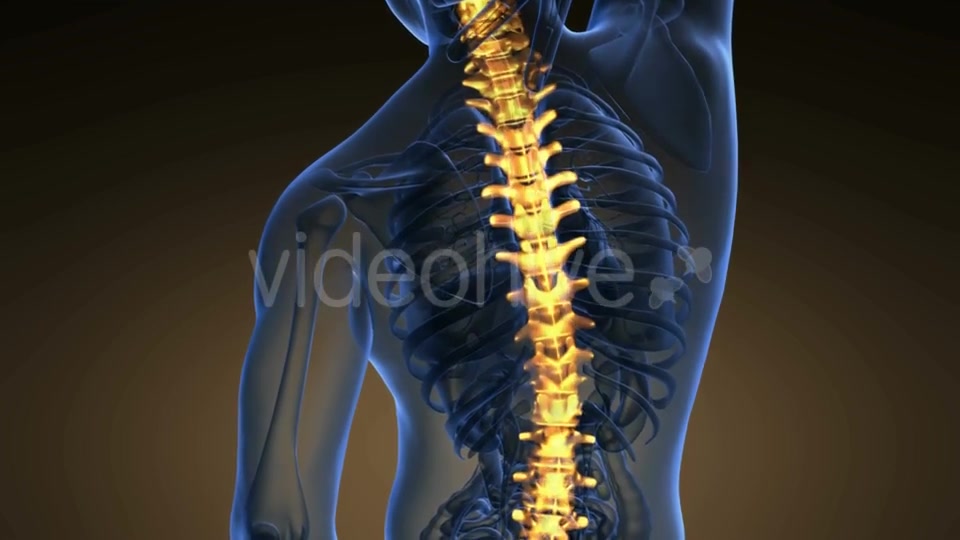 Backache in Back Bones - Download Videohive 21225321