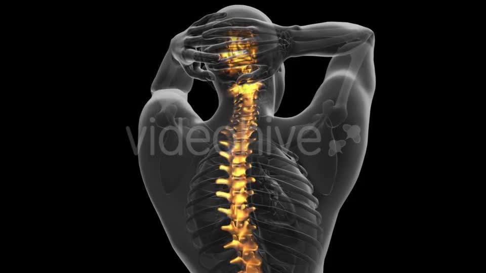 Backache in Back Bones - Download Videohive 21225374