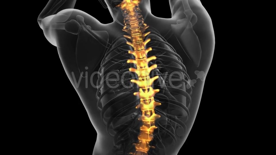 Backache in Back Bones - Download Videohive 21225374