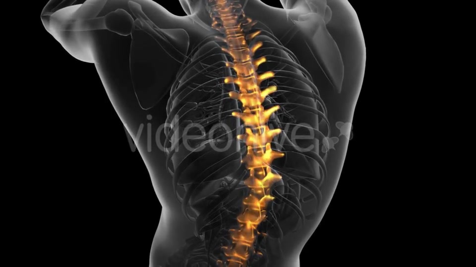 Backache in Back Bones - Download Videohive 21225374