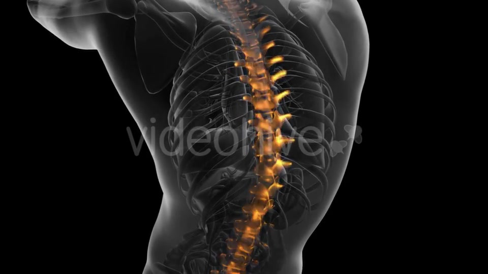 Backache in Back Bones - Download Videohive 21225374