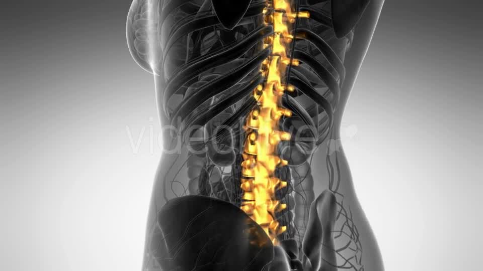 Backache in Back Bones - Download Videohive 21264128