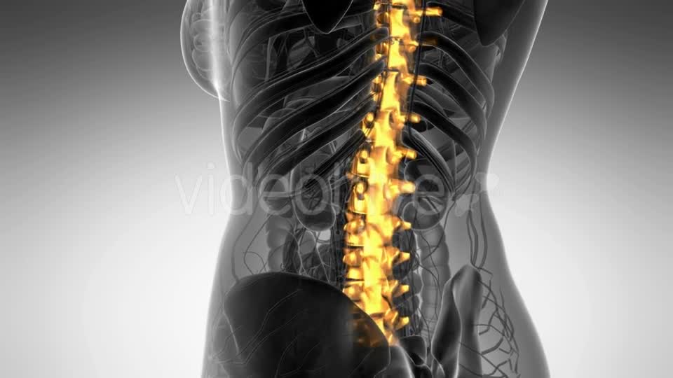 Backache in Back Bones - Download Videohive 21264128
