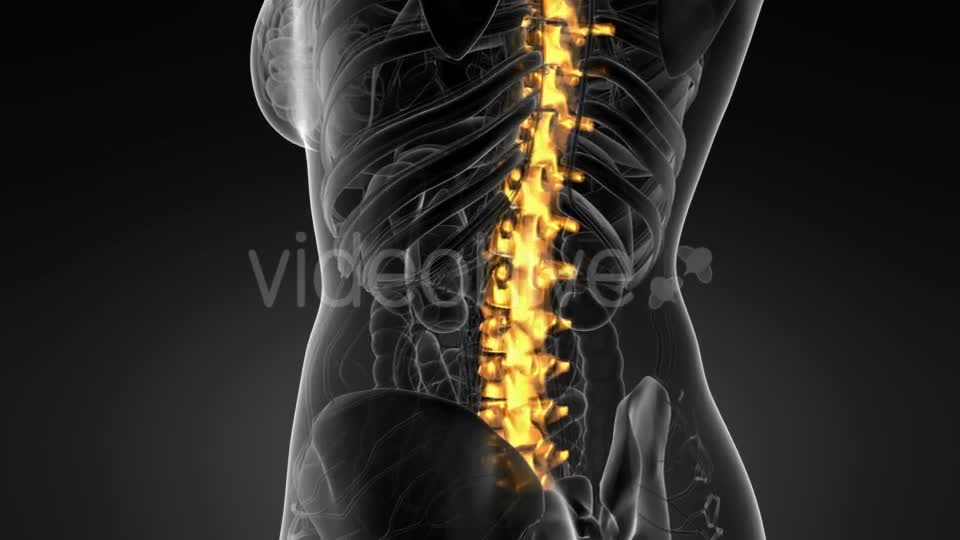 Backache in Back Bones - Download Videohive 21264181