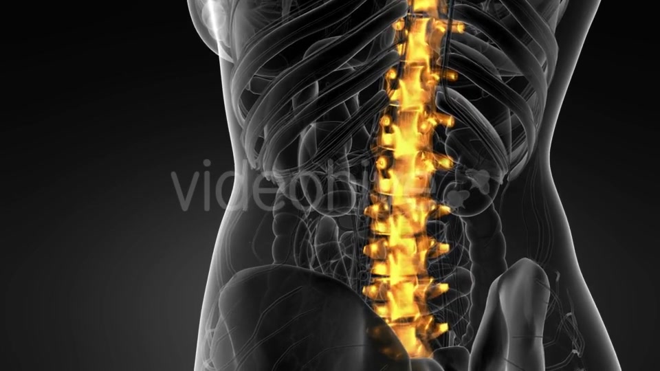 Backache in Back Bones - Download Videohive 21264181