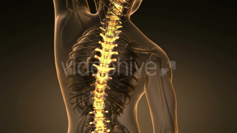 Backache in Back Bones - Download Videohive 21264275