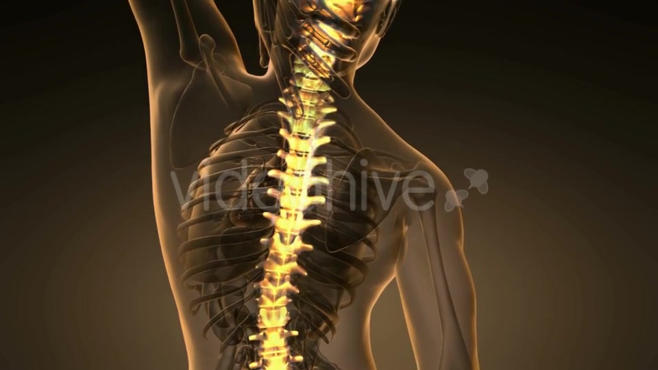 Backache in Back Bones - Download Videohive 21264275