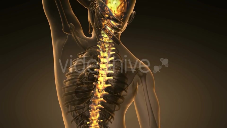 Backache in Back Bones - Download Videohive 21264275