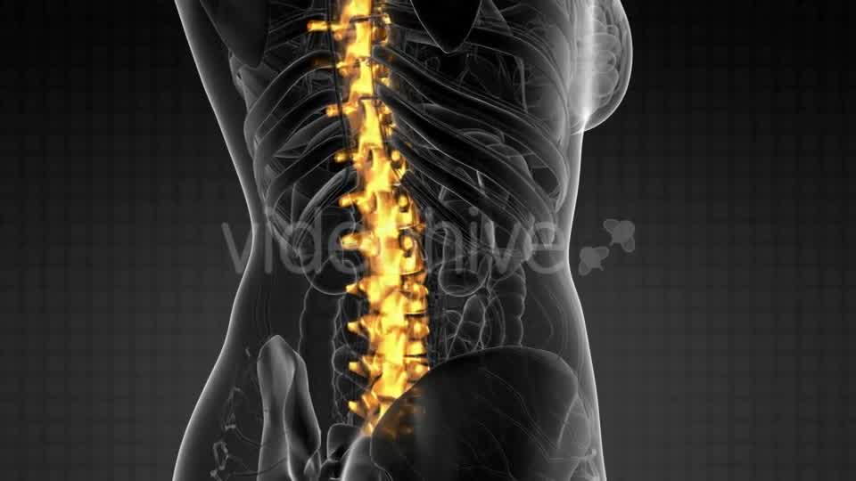 Backache in Back Bones - Download Videohive 21264300