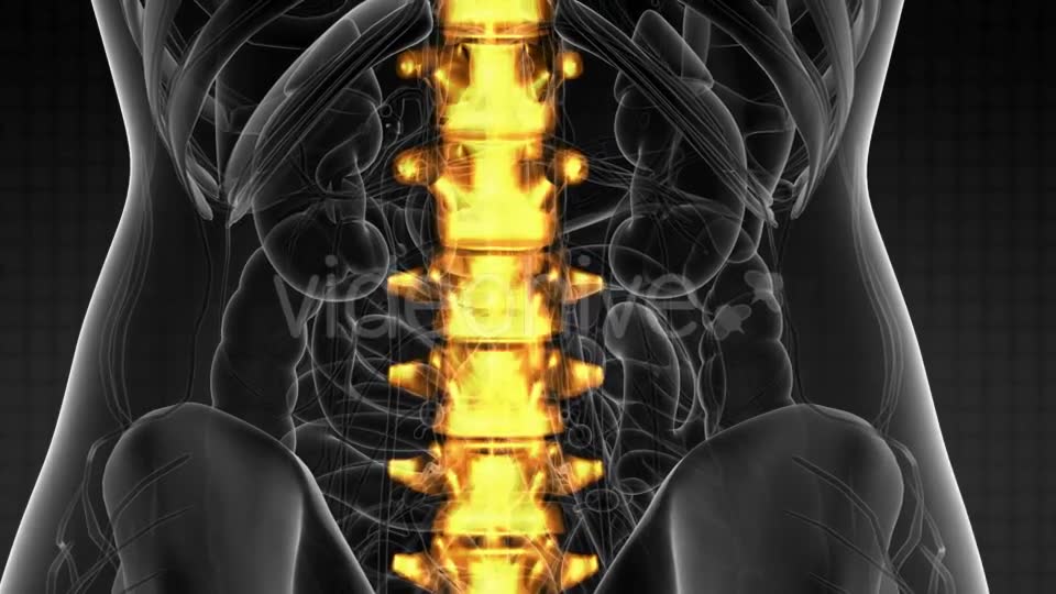 Backache in Back Bones - Download Videohive 21264300