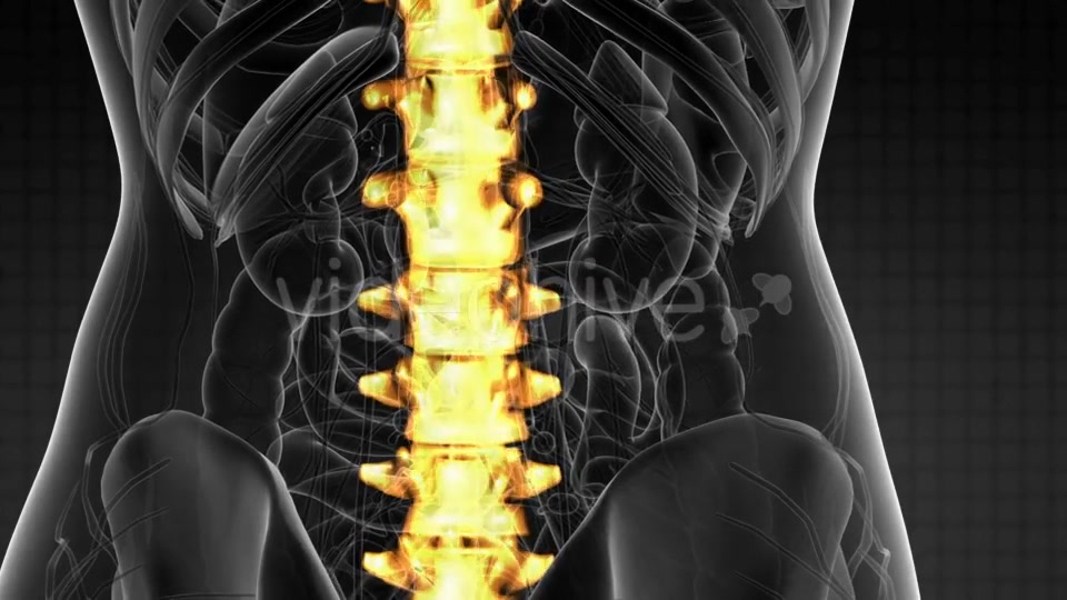 Backache in Back Bones - Download Videohive 21264300