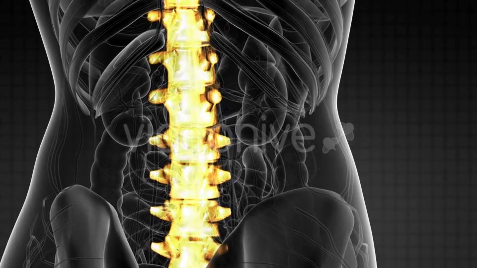 Backache in Back Bones - Download Videohive 21264300