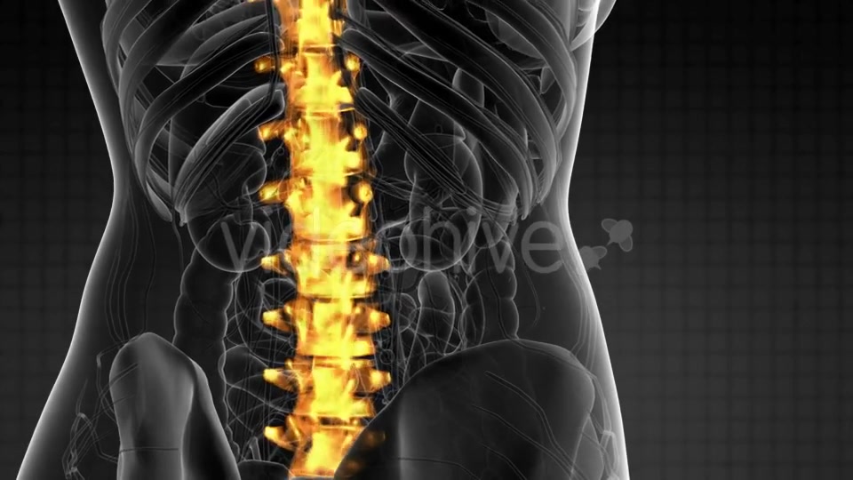 Backache in Back Bones - Download Videohive 21264300