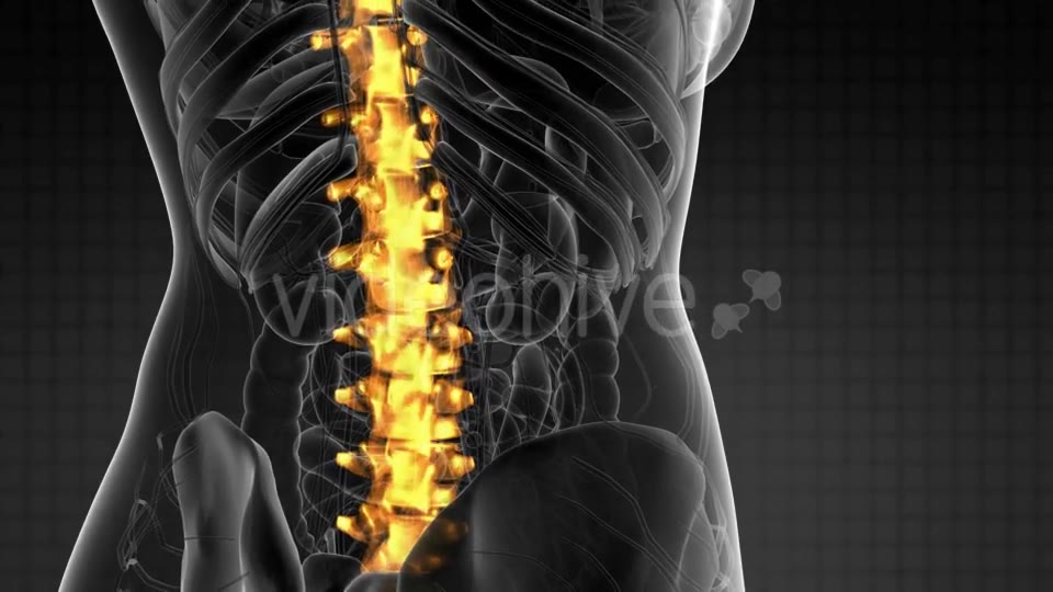 Backache in Back Bones - Download Videohive 21264300