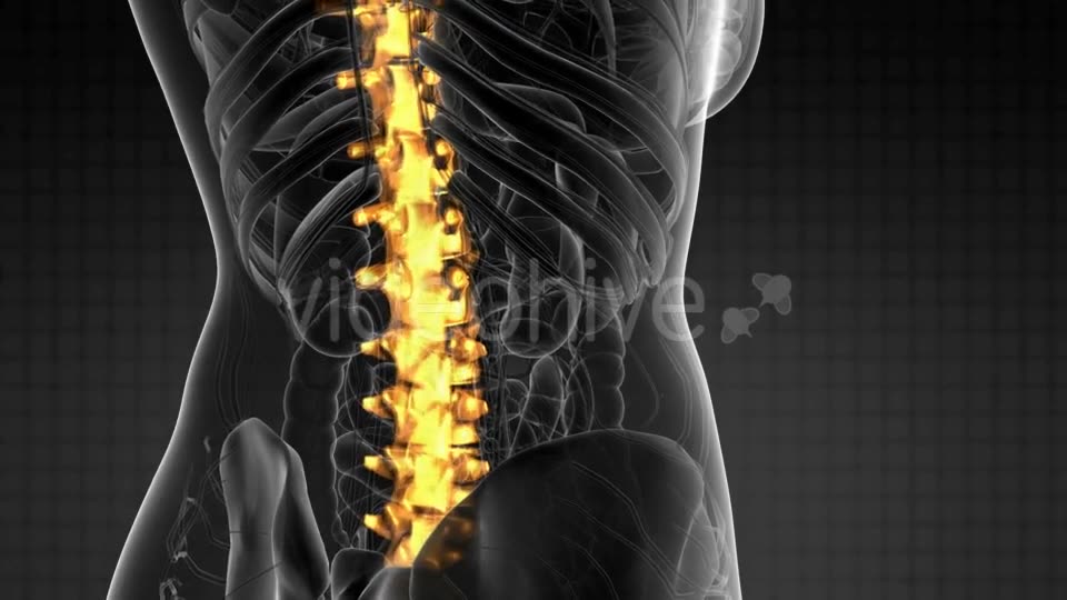 Backache in Back Bones - Download Videohive 21264300