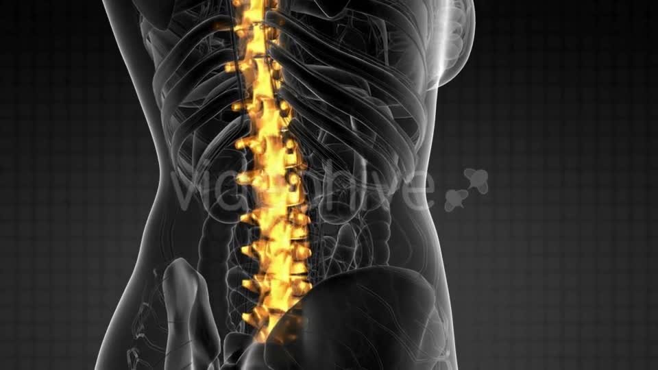 Backache in Back Bones - Download Videohive 21264300