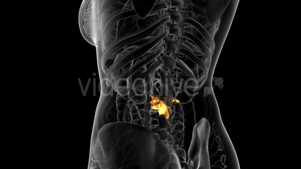 Backache in Back Bones - Download Videohive 21314006