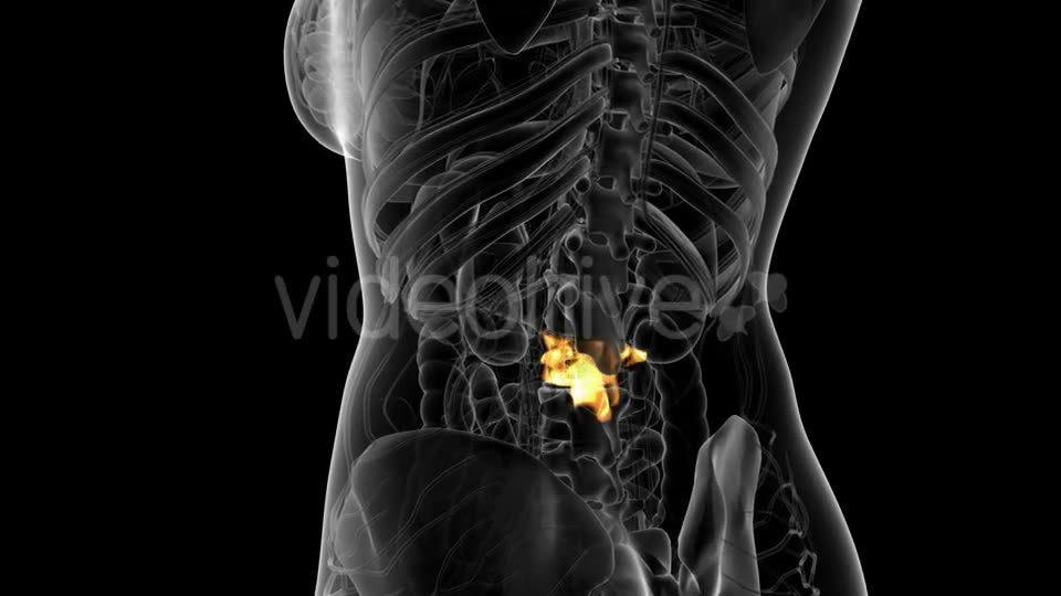 Backache in Back Bones - Download Videohive 21314006