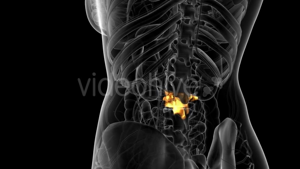 Backache in Back Bones - Download Videohive 21314006