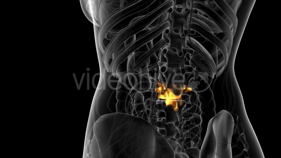 Backache in Back Bones - Download Videohive 21314006