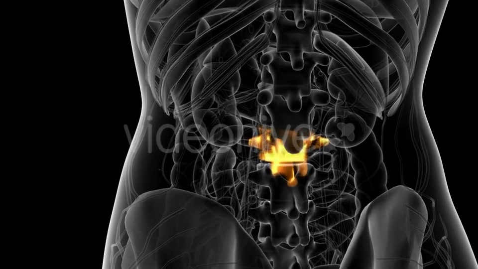 Backache in Back Bones - Download Videohive 21314006