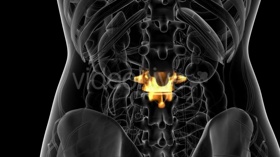 Backache in Back Bones - Download Videohive 21314006