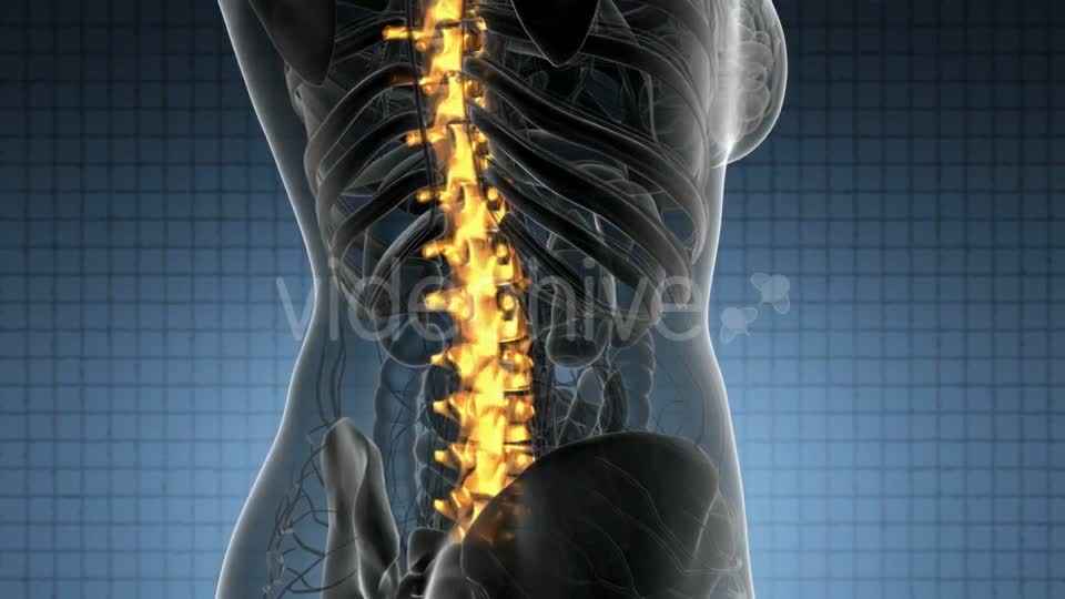 Backache in Back Bones - Download Videohive 21389078