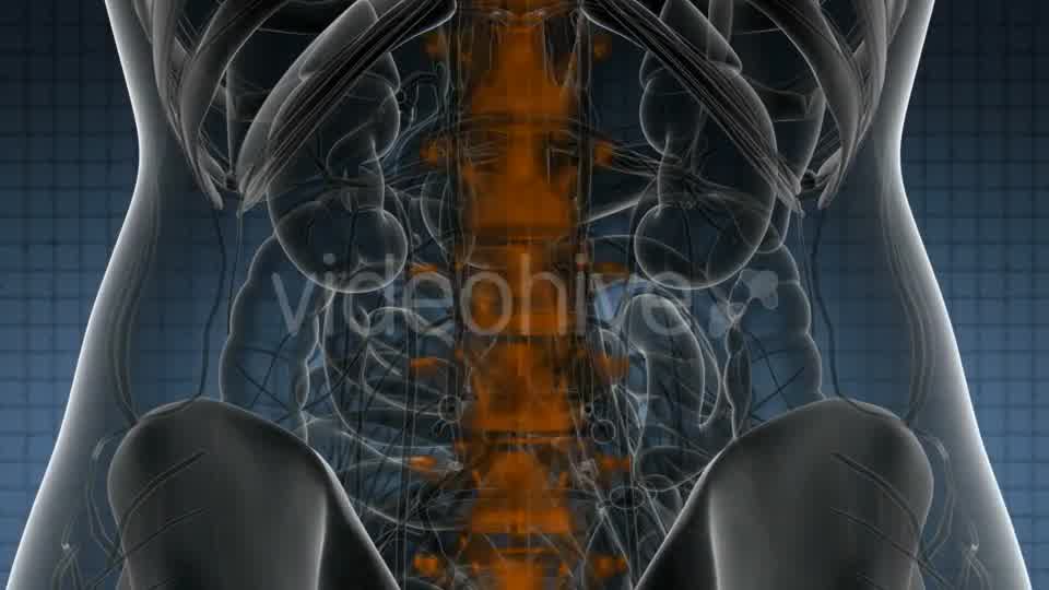 Backache in Back Bones - Download Videohive 21389078