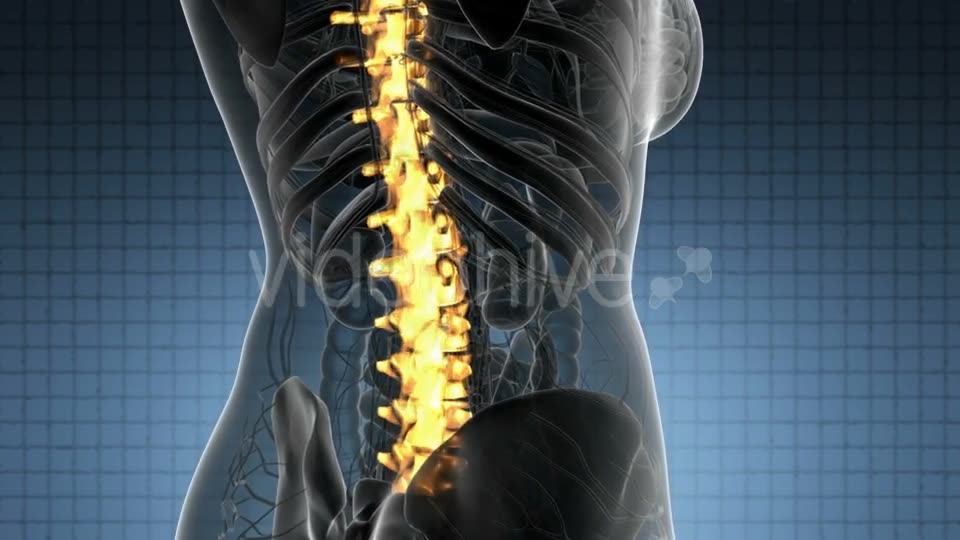 Backache in Back Bones - Download Videohive 21389078