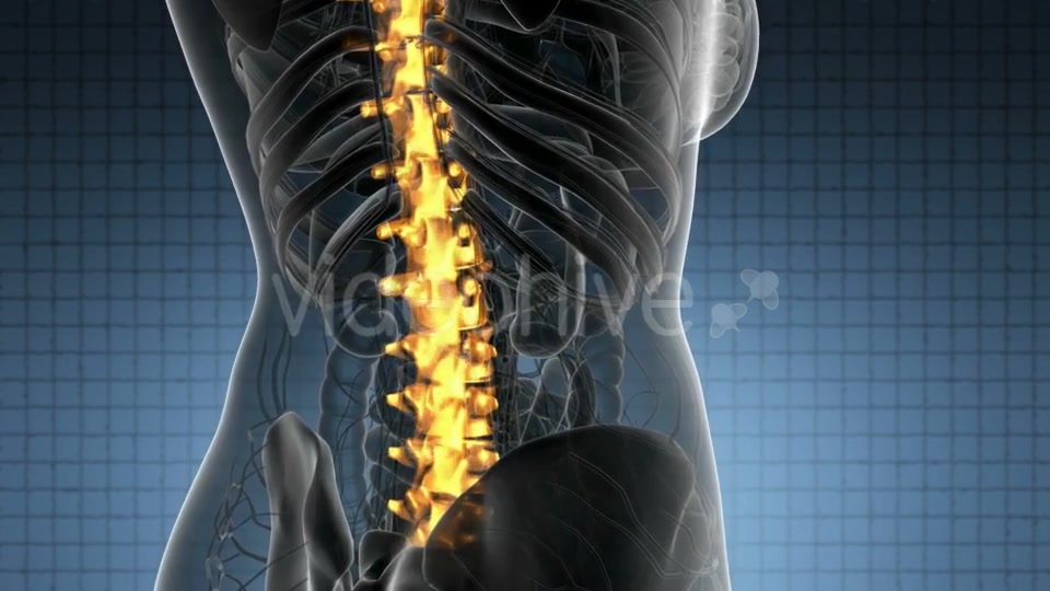 Backache in Back Bones - Download Videohive 21389078