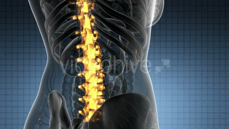 Backache in Back Bones - Download Videohive 21389078