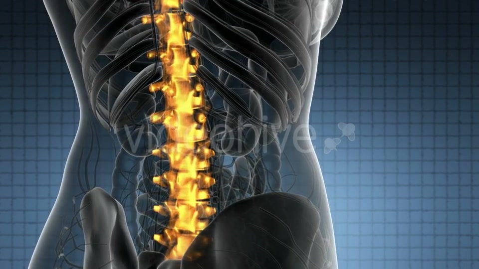 Backache in Back Bones - Download Videohive 21389078