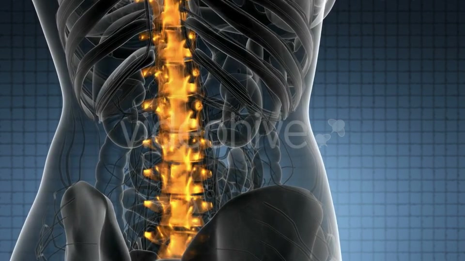 Backache in Back Bones - Download Videohive 21389078