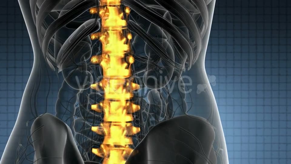 Backache in Back Bones - Download Videohive 21389078