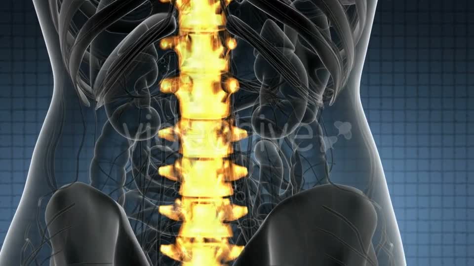 Backache in Back Bones - Download Videohive 21389078