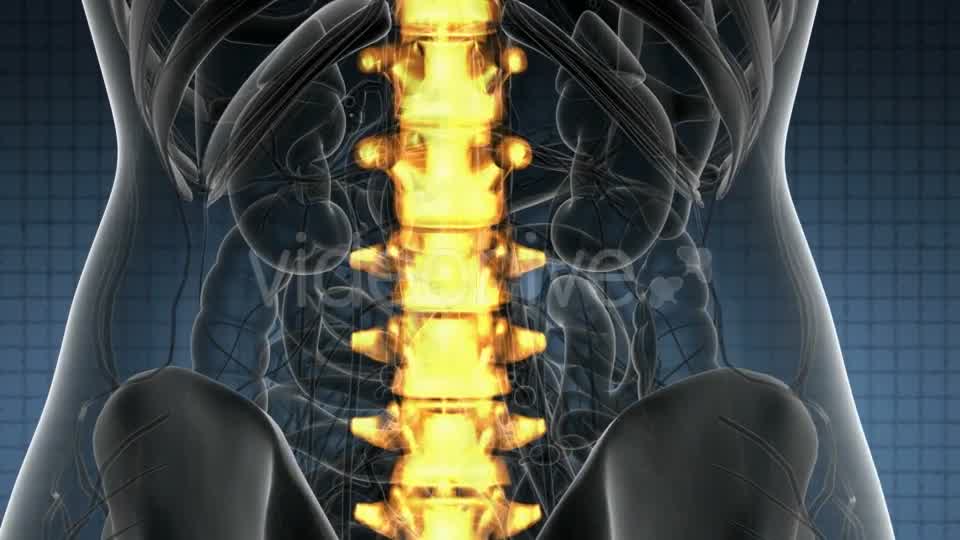 Backache in Back Bones - Download Videohive 21389078