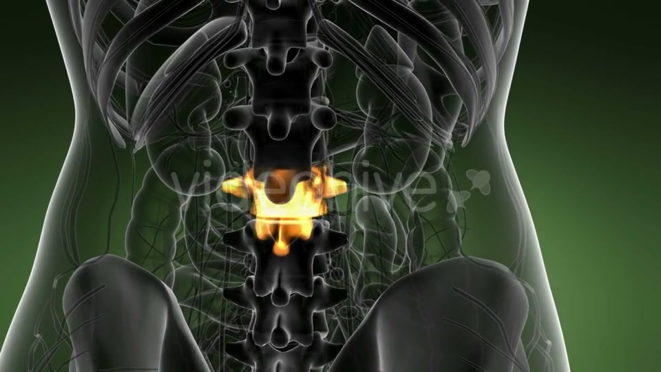 Backache in Back Bones - Download Videohive 21389549