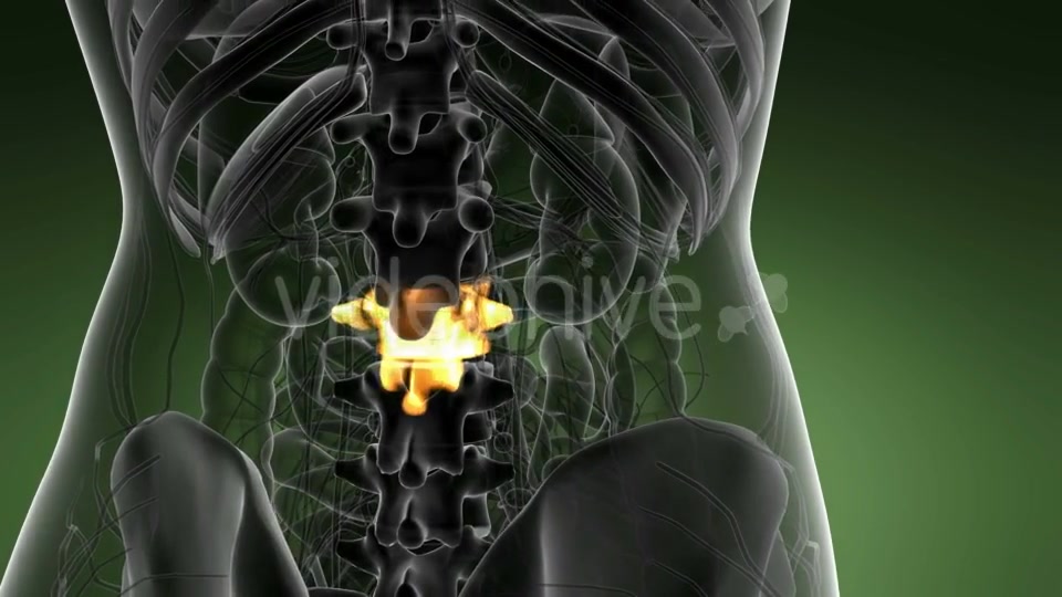 Backache in Back Bones - Download Videohive 21389549
