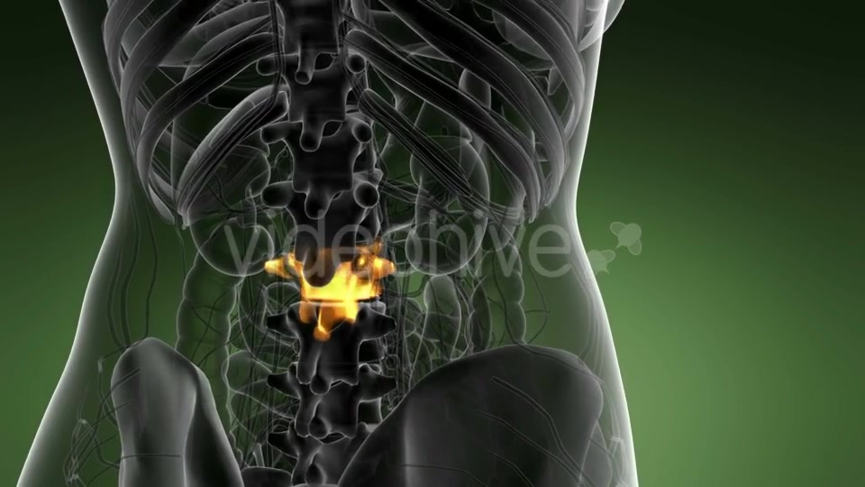 Backache in Back Bones - Download Videohive 21389549