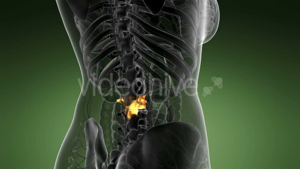 Backache in Back Bones - Download Videohive 21389549