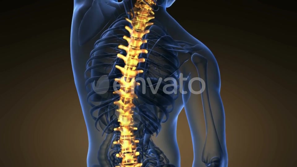Backache in Back Bones - Download Videohive 21722601