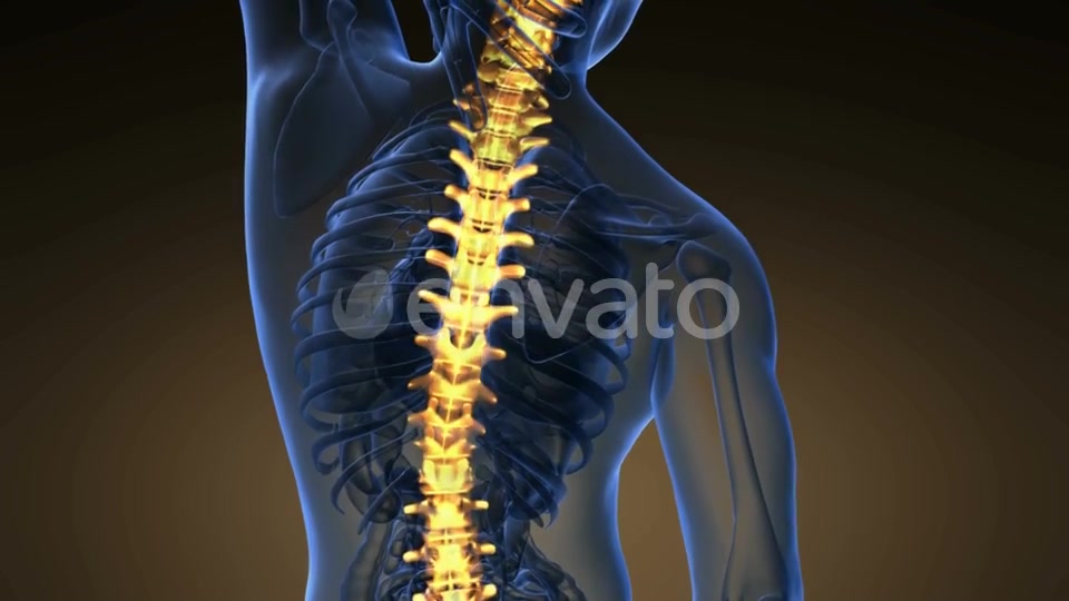 Backache in Back Bones - Download Videohive 21722601