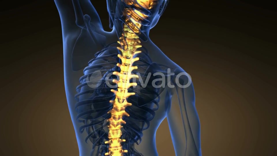 Backache in Back Bones - Download Videohive 21722601