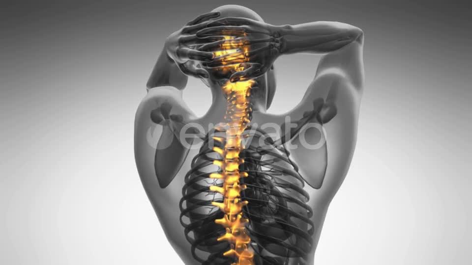 Backache in Back Bones - Download Videohive 21723222