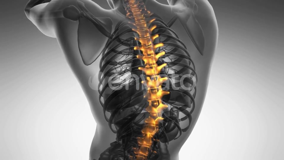 Backache in Back Bones - Download Videohive 21723222