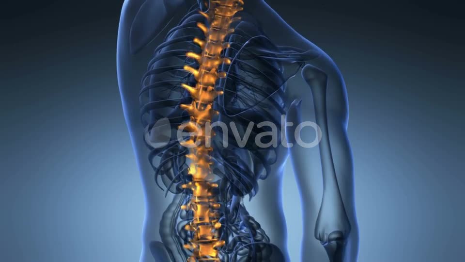 Backache in Back Bones - Download Videohive 21842776