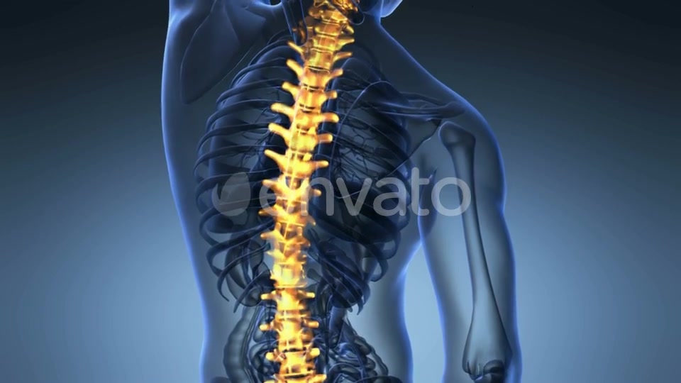 Backache in Back Bones - Download Videohive 21842776