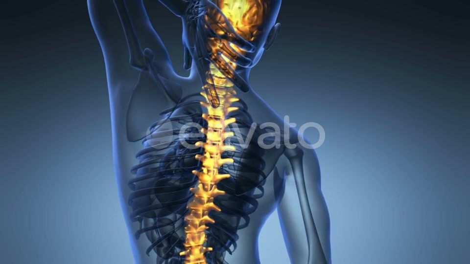 Backache in Back Bones - Download Videohive 21842776